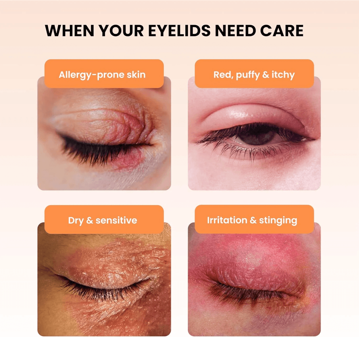 BlephaDerm