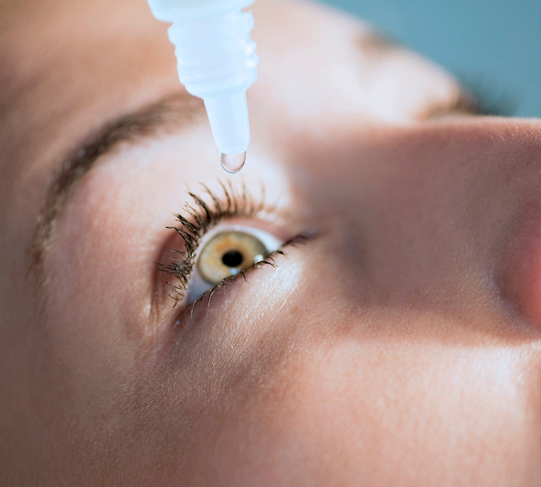 Eye drop is being used to treat dry eye disease in the photo