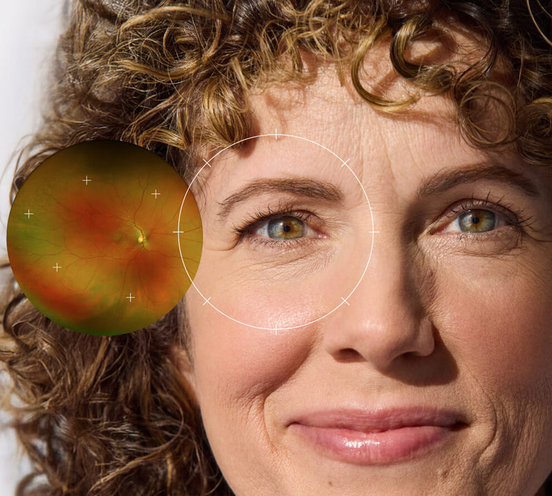 Eye Exams & Vision Coverage: What You Need to Know